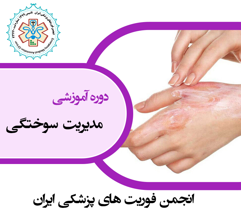 مدیریت سوختگی